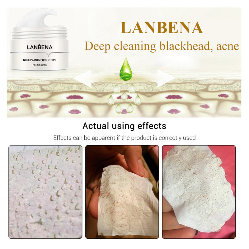 ClearNose Blackhead Remove