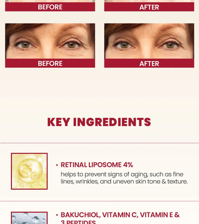 KSECRET - SEOUL 1988 Eye Cream : Retinal Liposome 4% + Fermented Bean