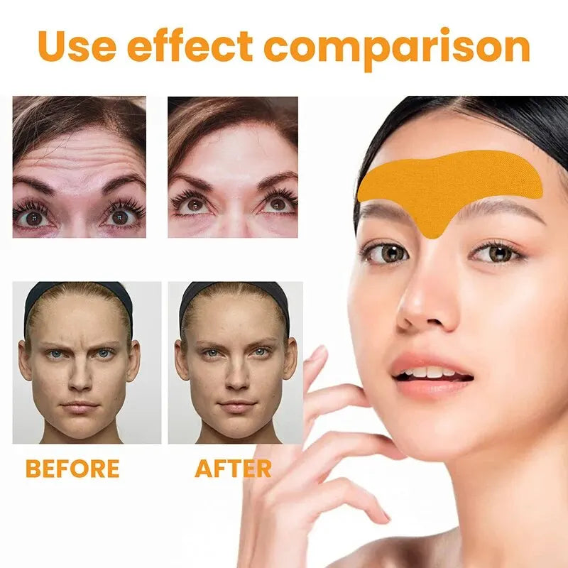 SmoothLift Forehead Patch