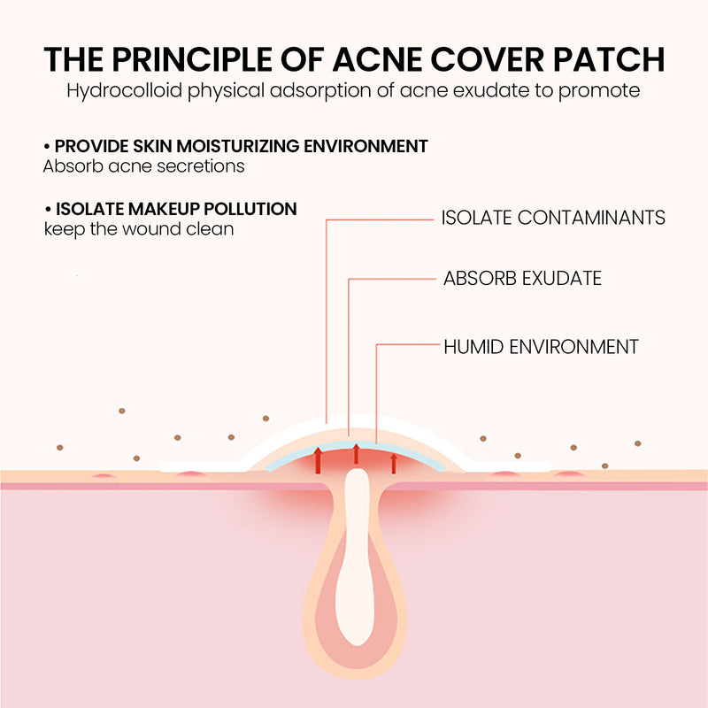 StarBlemish: Hydrocolloid Acne Patches